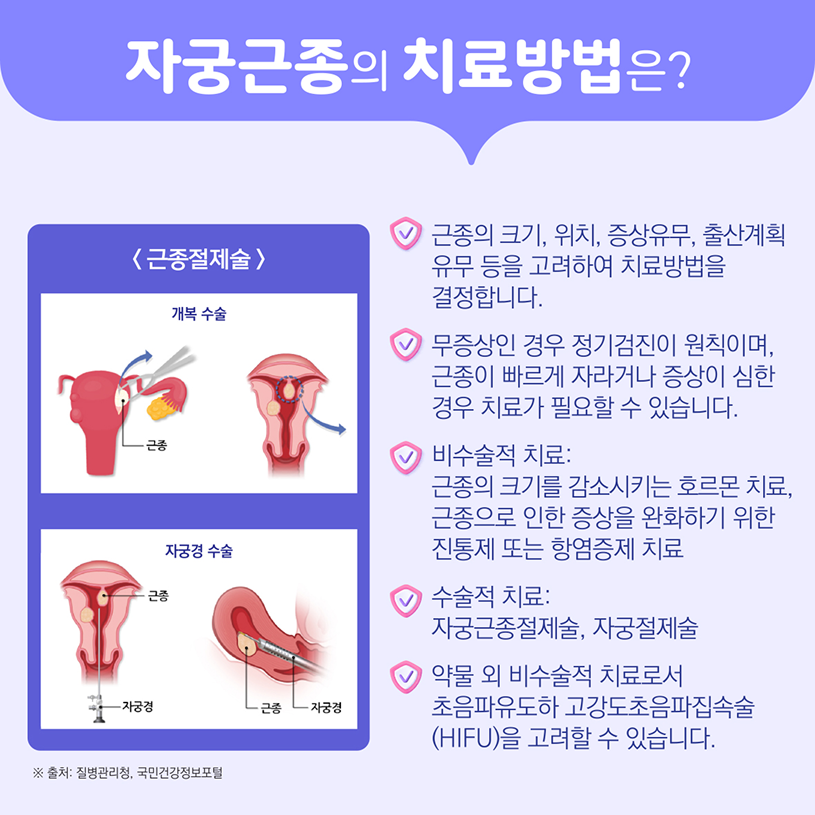 자궁근종의 치료방법은? 상세내용 하단참조