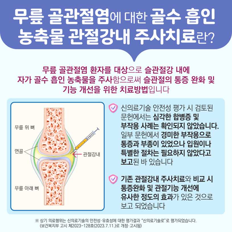 무릎 골관절염에 대한 골수 흡인 농축물 관절강내 주사치료란? 상세내용 하단참조